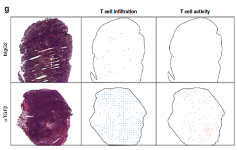 scRNA-seq+空间转录组，揭示TGFβ阻断重塑肿瘤基质景观医药新闻-ByDrug-一站式医药资源共享中心-医药魔方