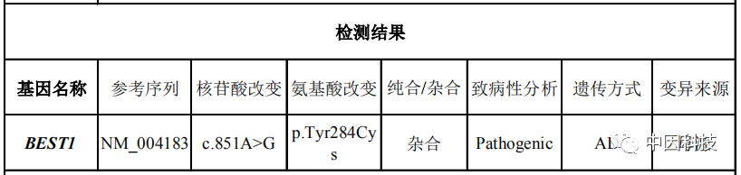 详解遗传性眼病——Best病医药新闻-ByDrug-一站式医药资源共享中心-医药魔方