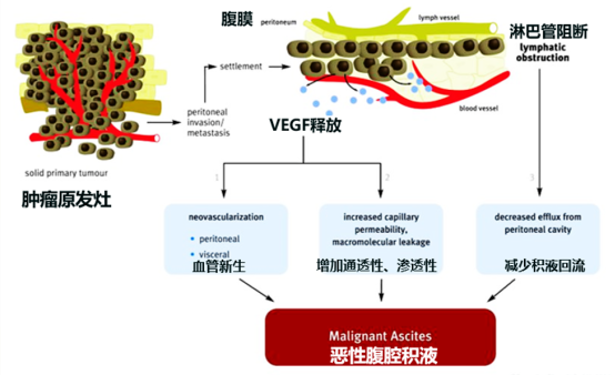先声药业恩度®联合顺铂治疗胸腹腔积液III期临床试验申请获CDE批准医药新闻-ByDrug-一站式医药资源共享中心-医药魔方